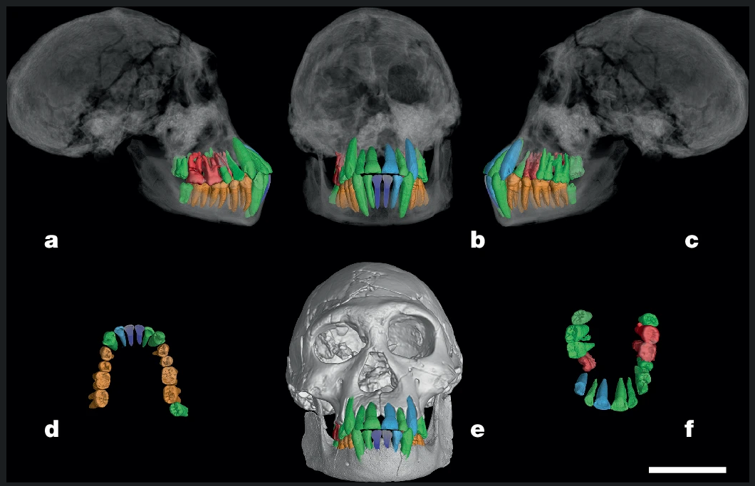 Dentition of Dmanisi skull D2700